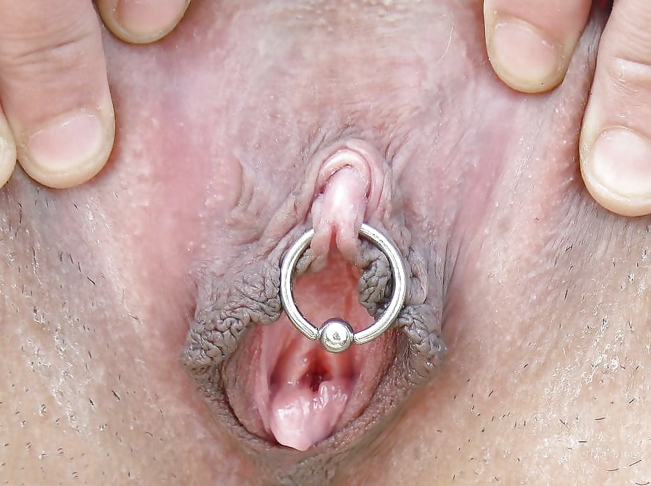 Abnormal vagina lips