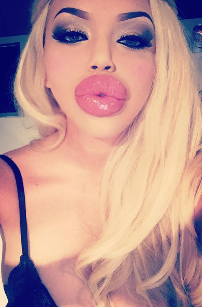 Big lips fetish gallery