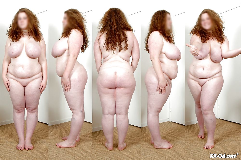 Naked Morbidly Obese Women.