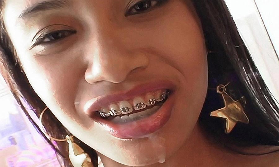 Girl With Braces Porn