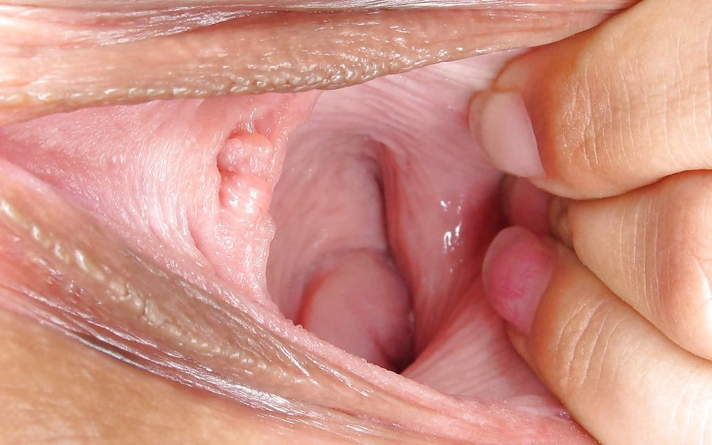 Vaginal Opening Pictures.
