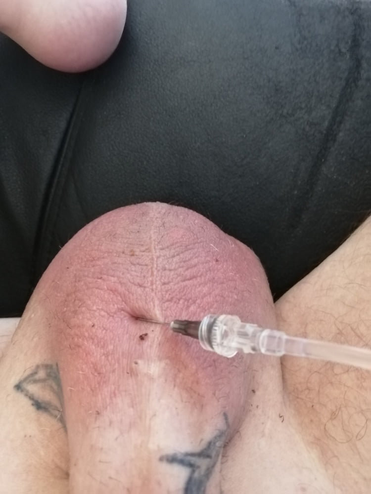 Saline Infusion Scrotum And Titti 3 L 72 Pics Xhamster 4017