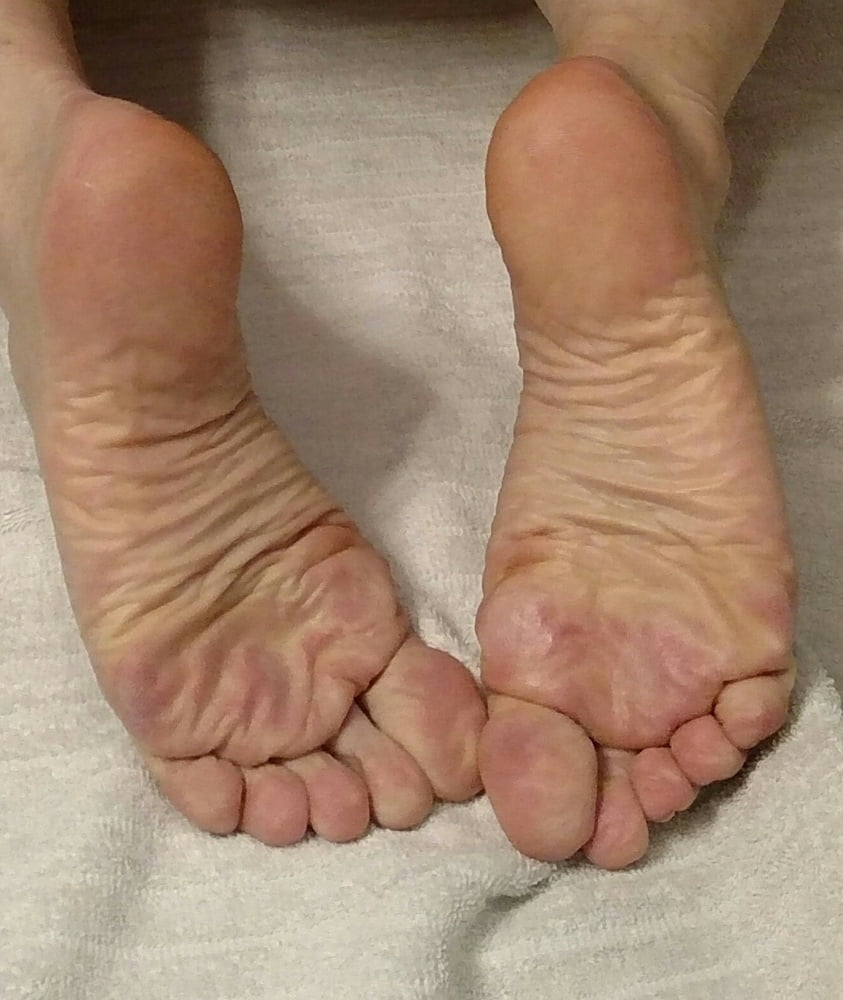 Wrinkled Soles Feet Foot Fetish 6 Pics