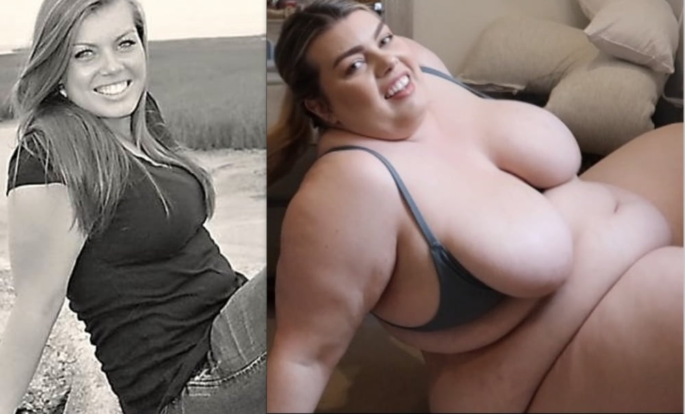 Weight Gain Before And After 7 - 31 Photos 