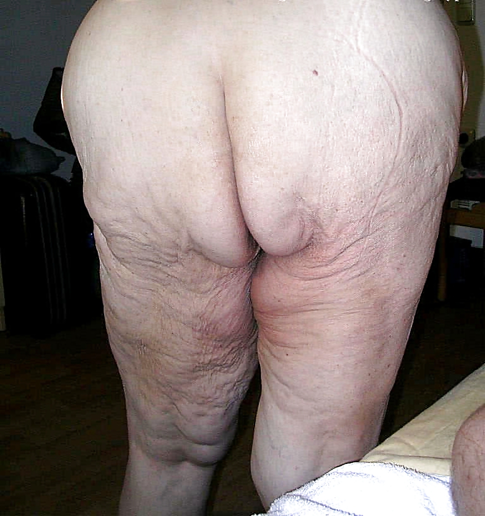 Wrinkled butt
