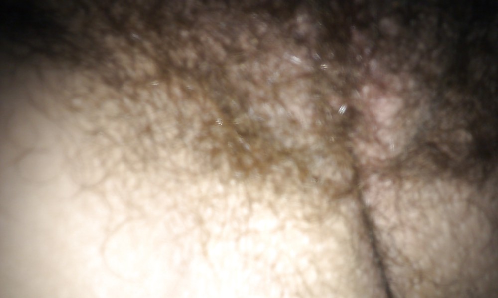 ex hairy pussy adult photos