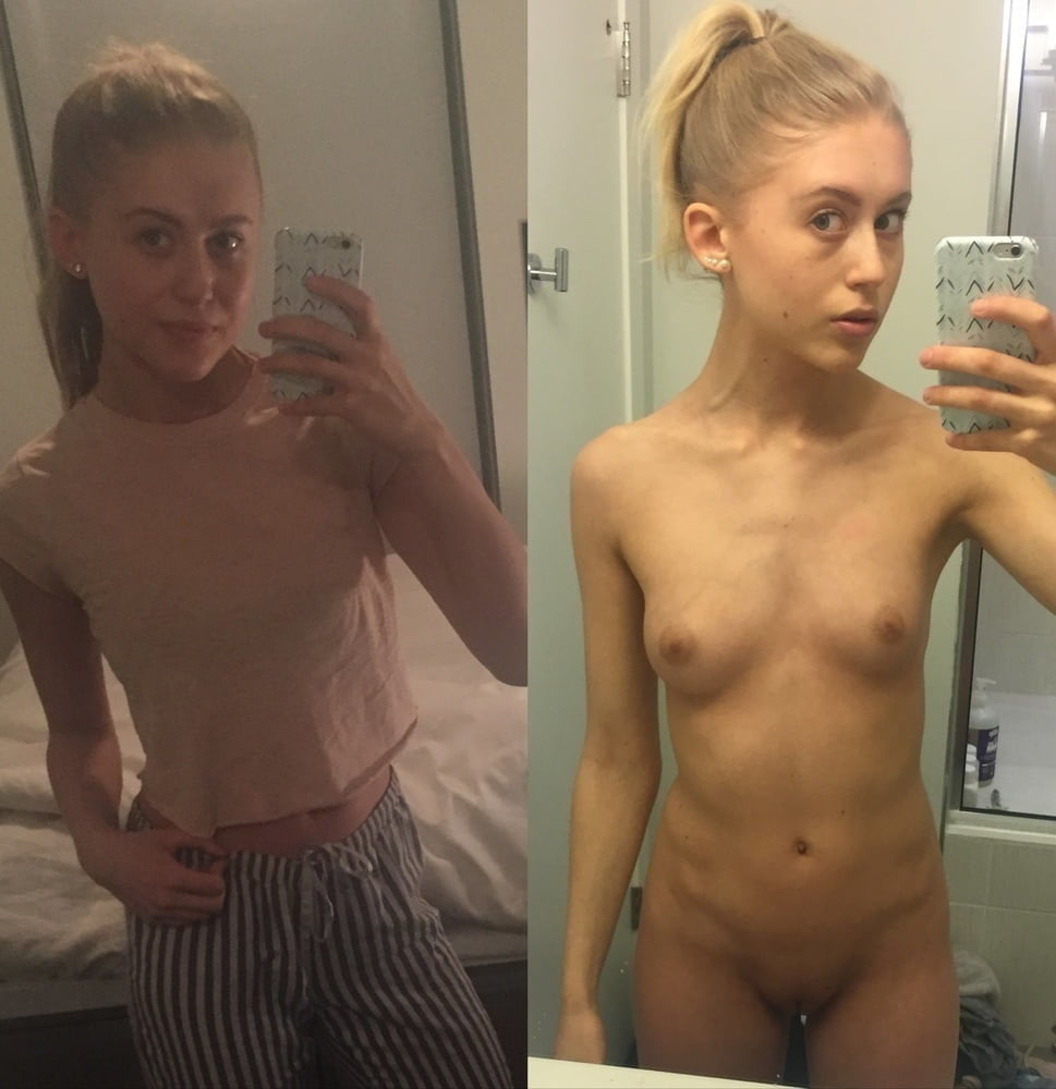 Before and After - Selfie 14 - 20 Pics 