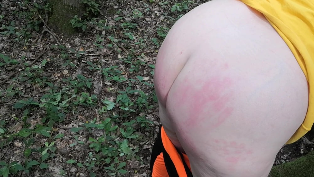 Ass Flogging in the woods - 11 Pics 