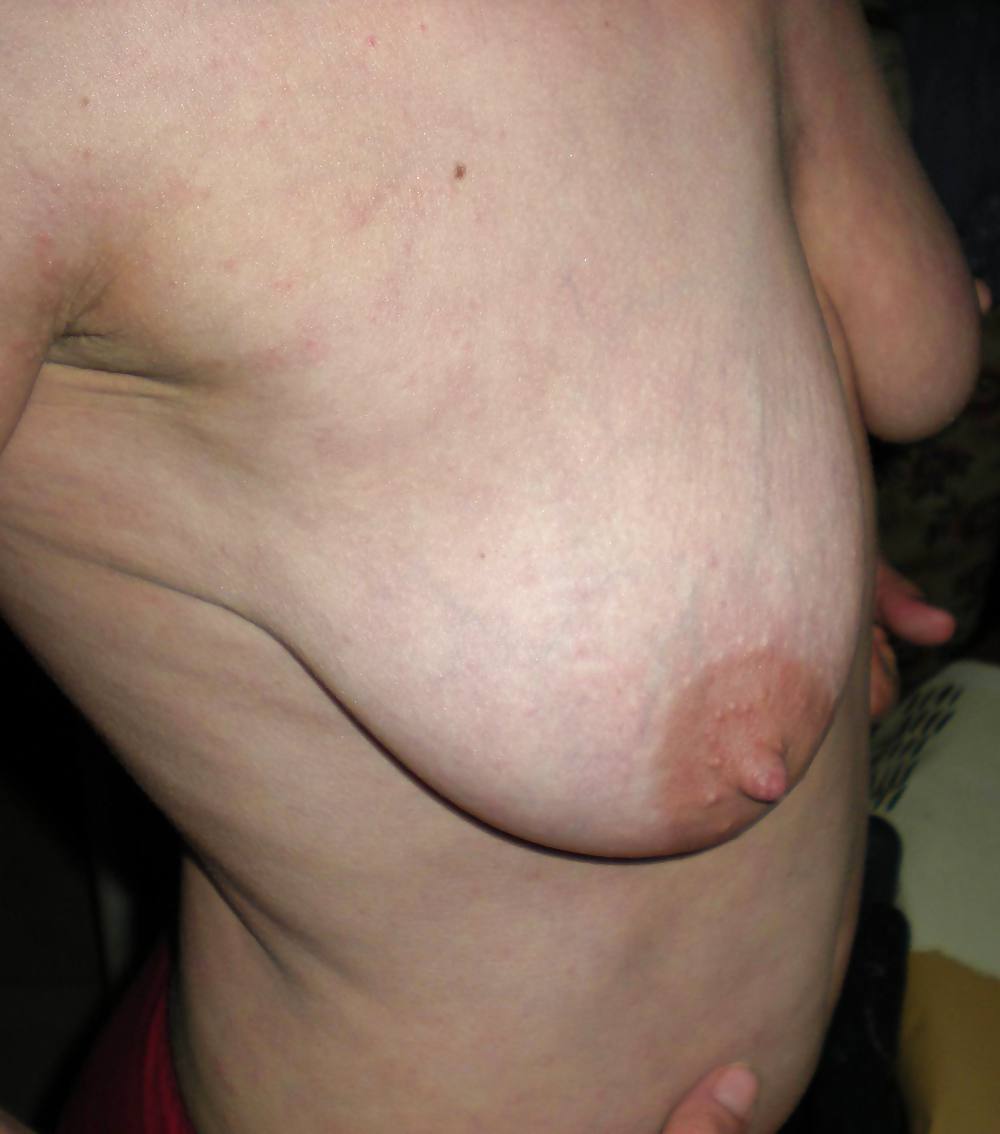 Seins    ( topless-Nipples ) adult photos