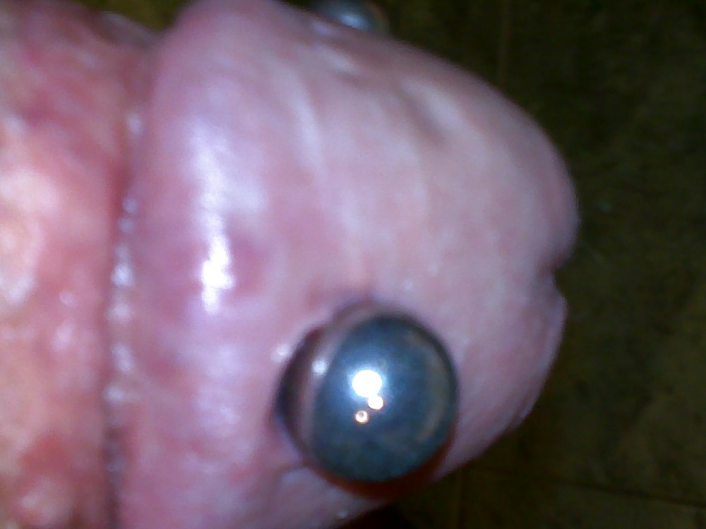 Penis saline injection 1 adult photos