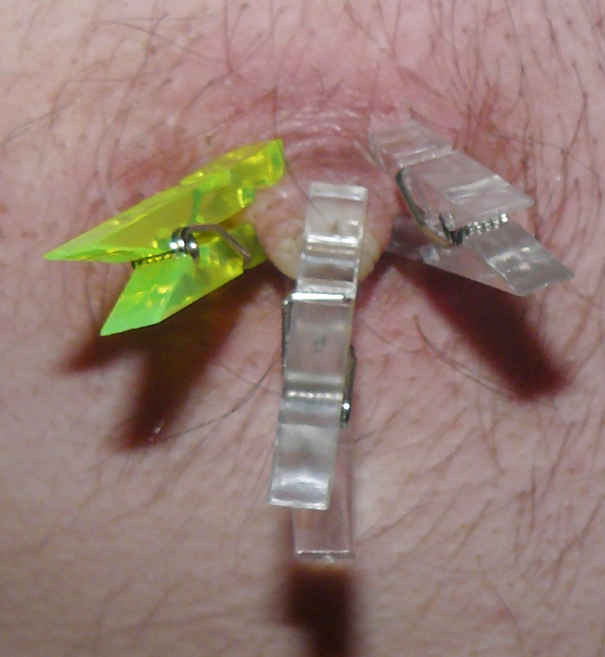 tits torture adult photos