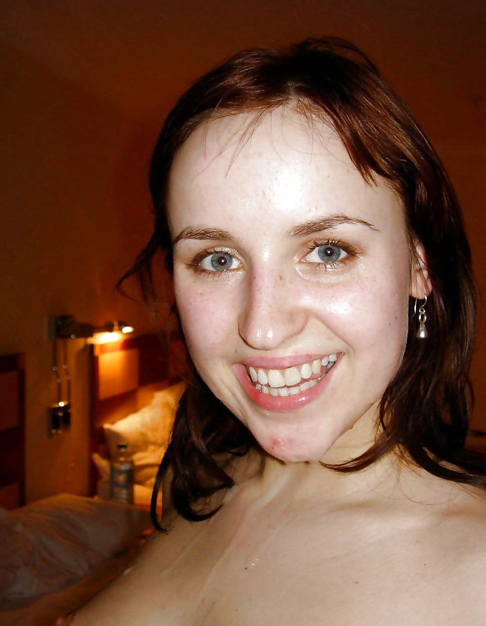 Acne, Freckles and Spots Wank Bank adult photos