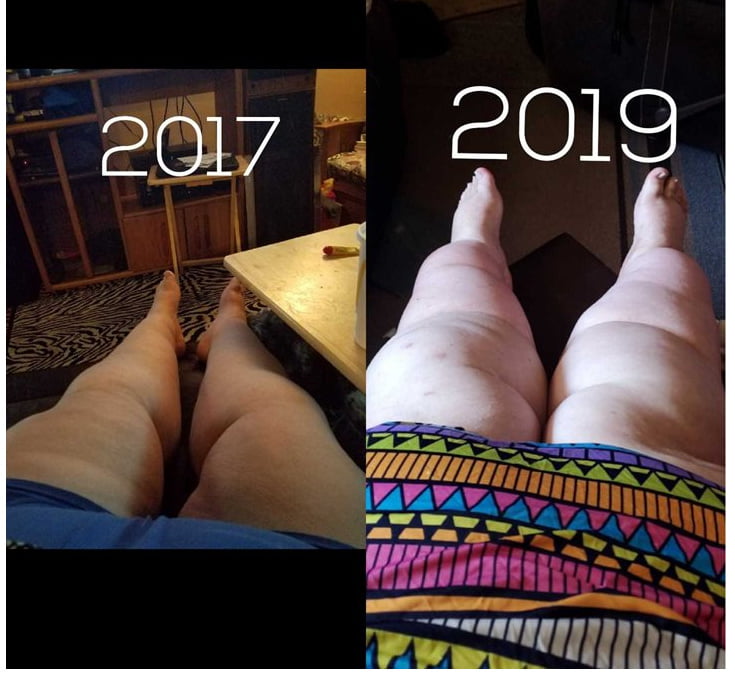 Weight Gain Before And After 8 - 29 Photos 