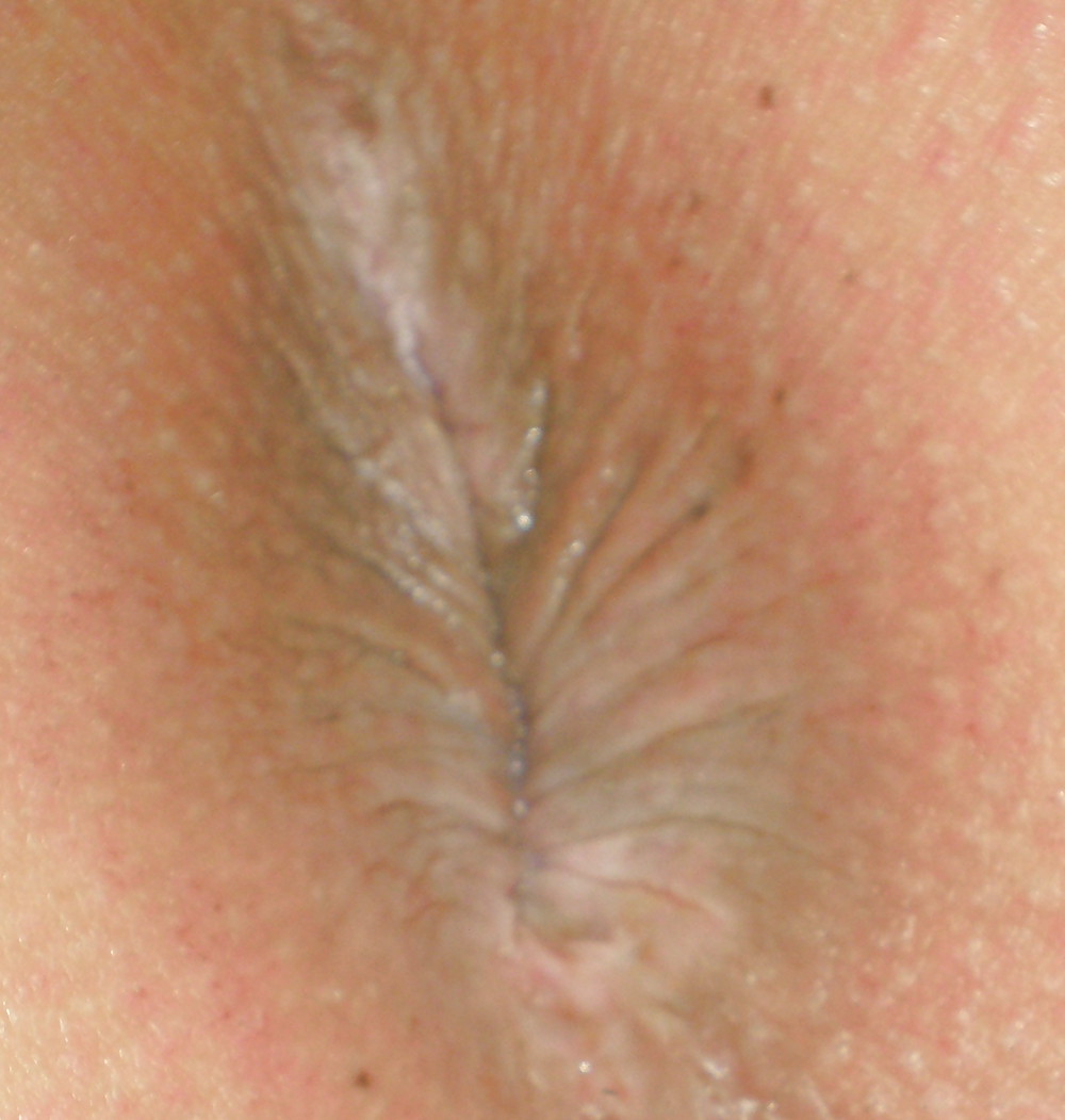 My girlie butthole as 18 years and 2 month old adult photos