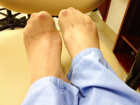 Nylon feet ER