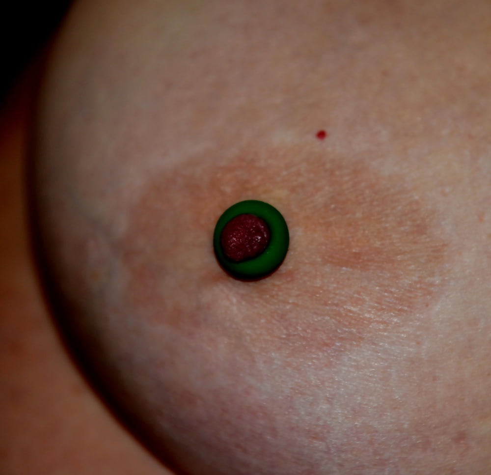 10-Mar-2016 Testing an Elastrator adult photos