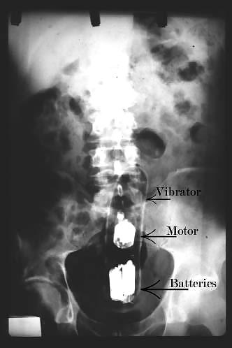 x-ray adult photos