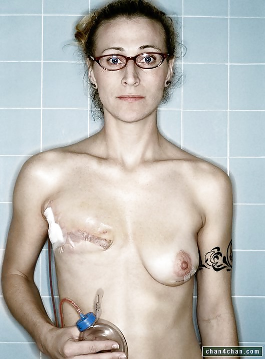 Amputee women adult photos