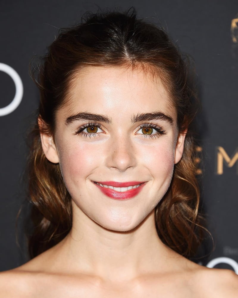 Kiernan shipka plastic surgery