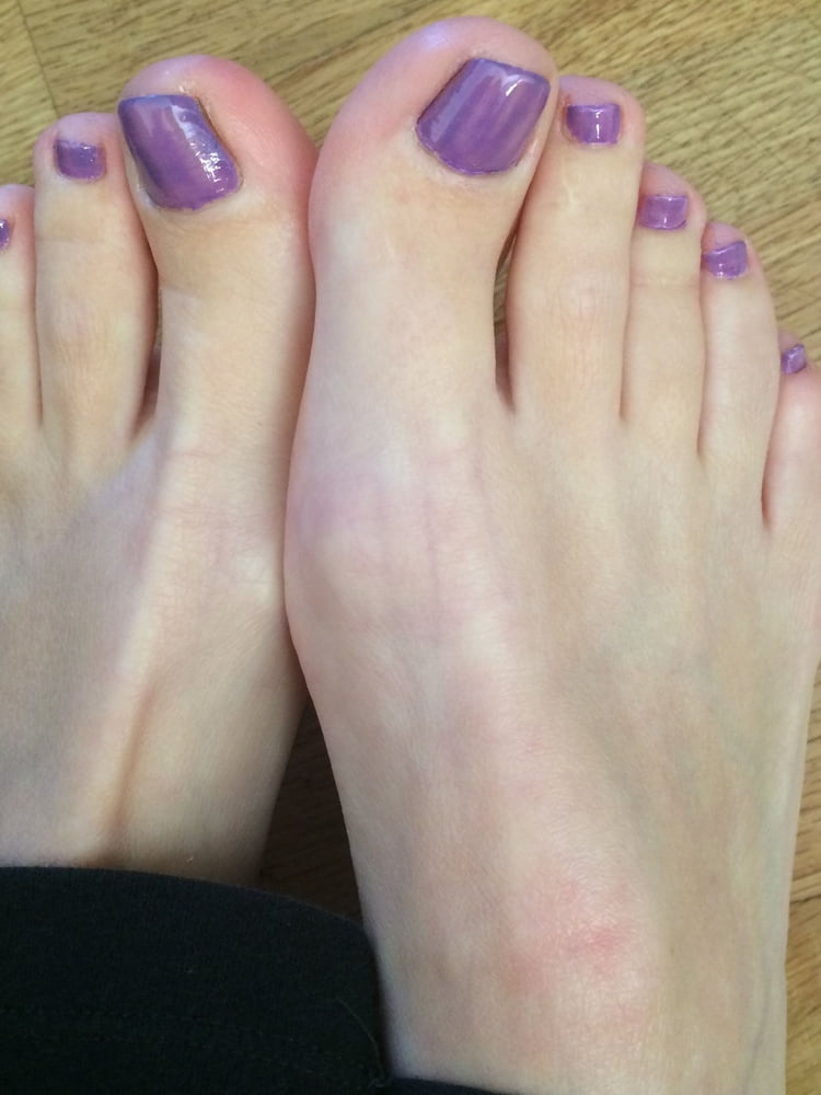 Milf Feet Porn Purple Nails - See and Save As milf feet porn pict - 4crot.com